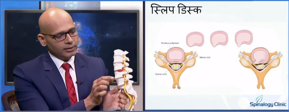 top best spine expert in pune for pain treatment