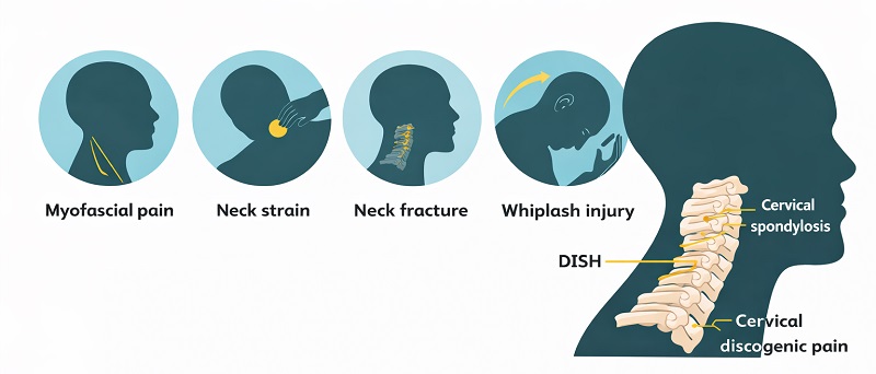 types and causes of neck pain in detail
