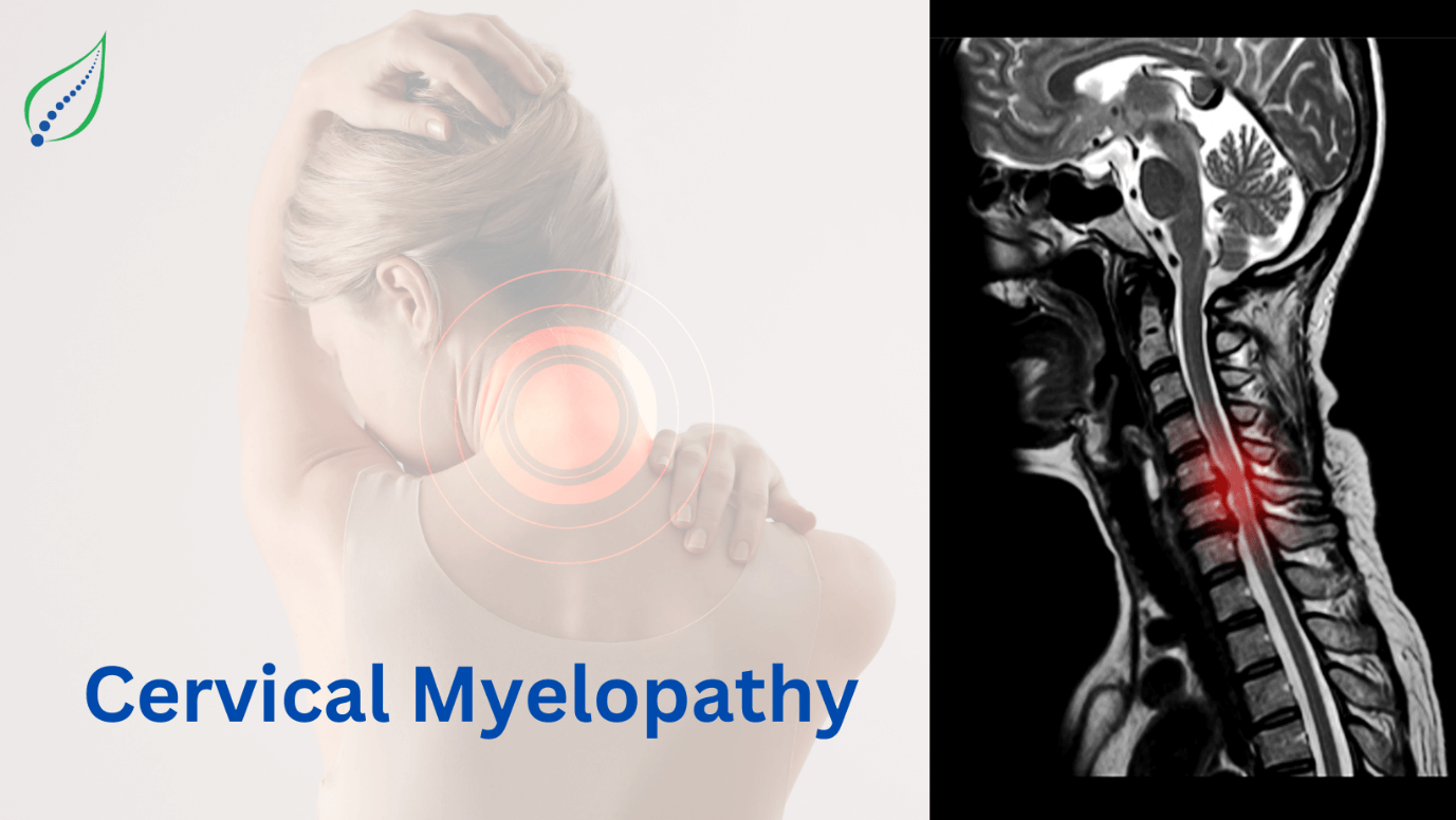 cervical-myelopathy