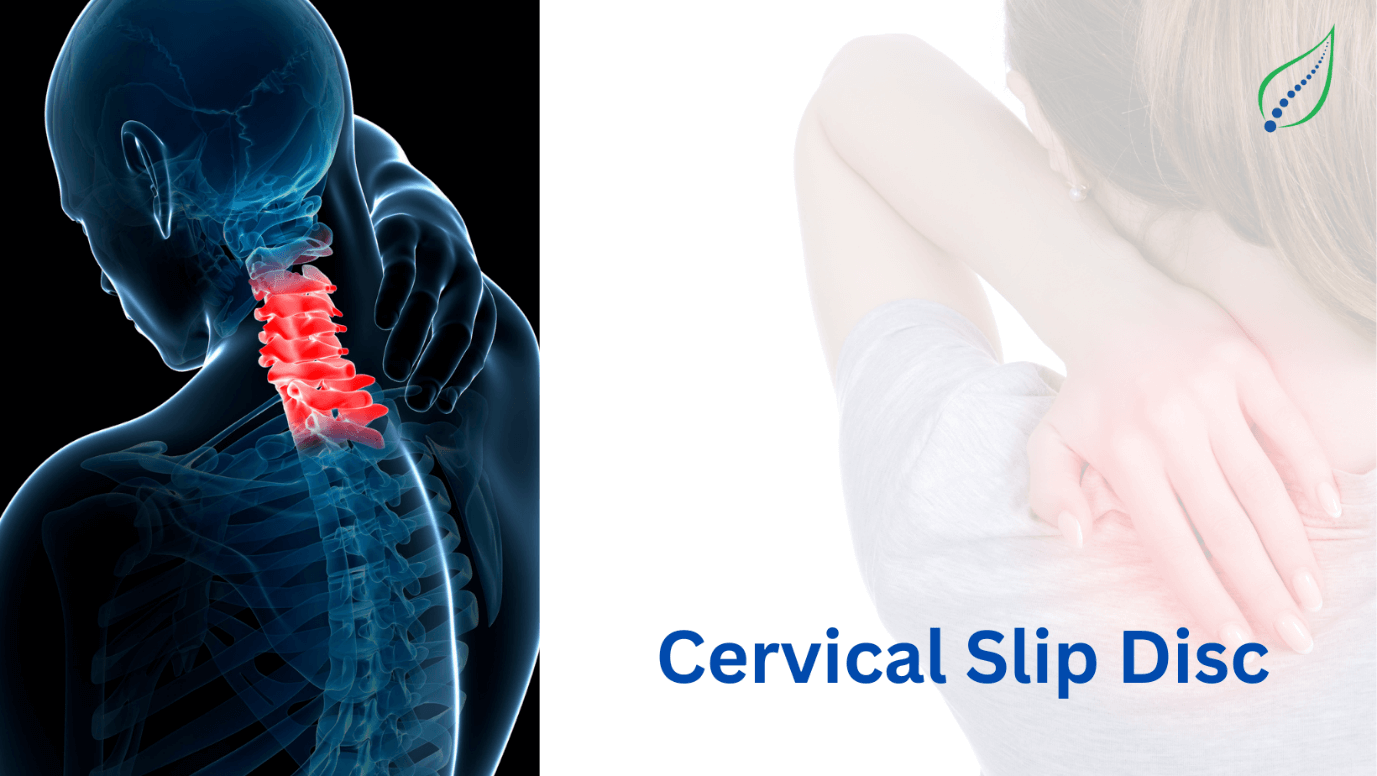 cervical-slip-disc