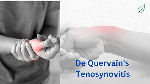 de-quervain-tenosynovitis