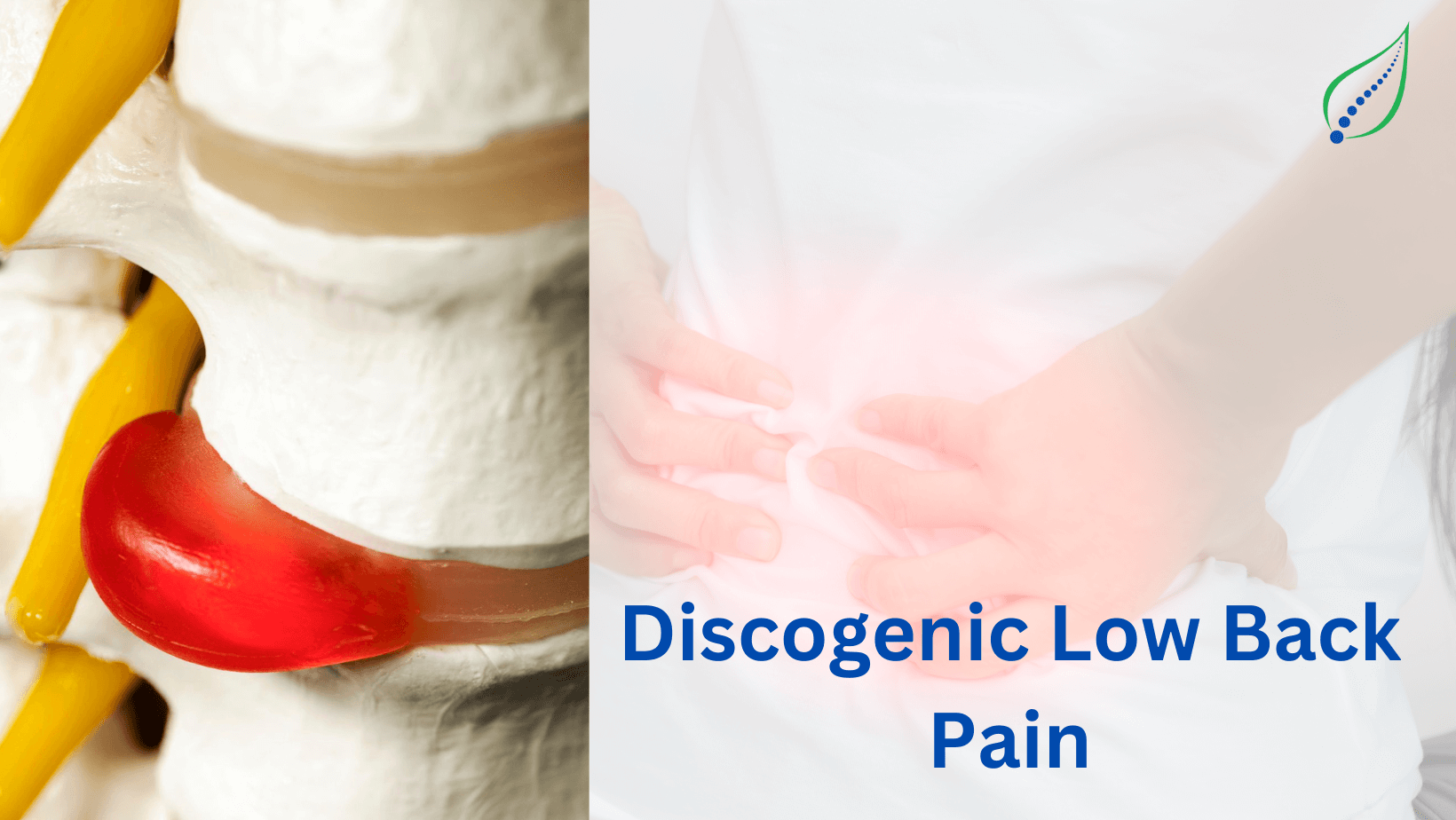 Discogenic LBP