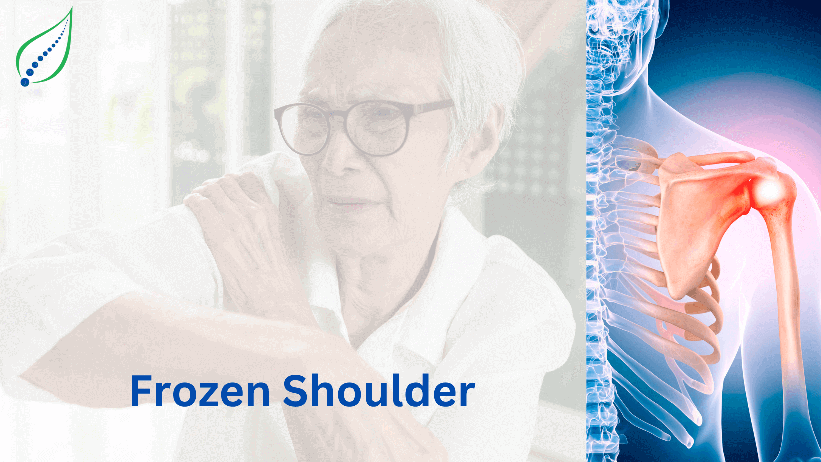 frozen-shoulder