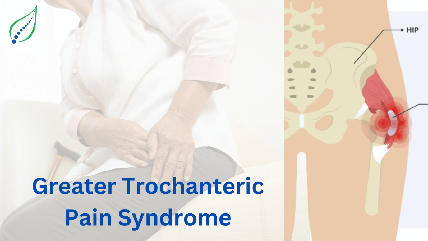 Greater Trochanteric Pain Syndrome