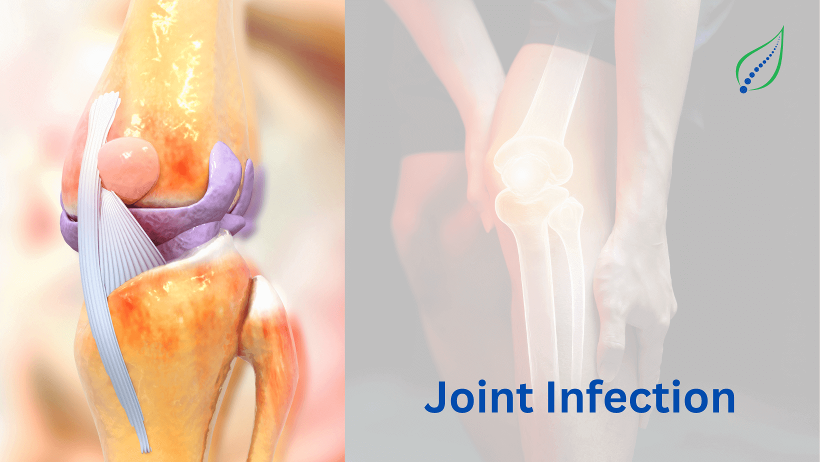 joint-infection