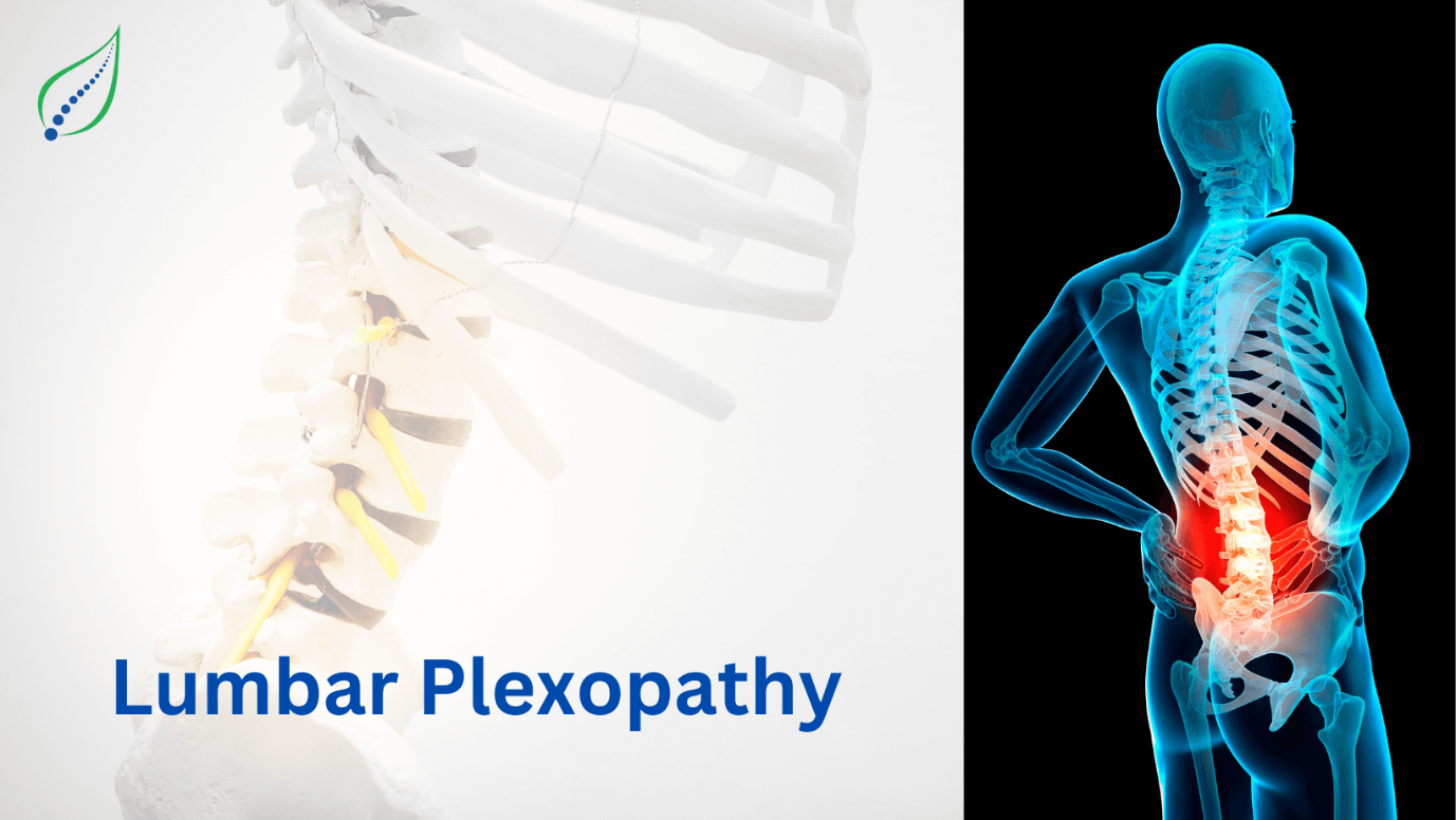 Lumbar Plexopathy