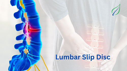 lumbar-slip-disc