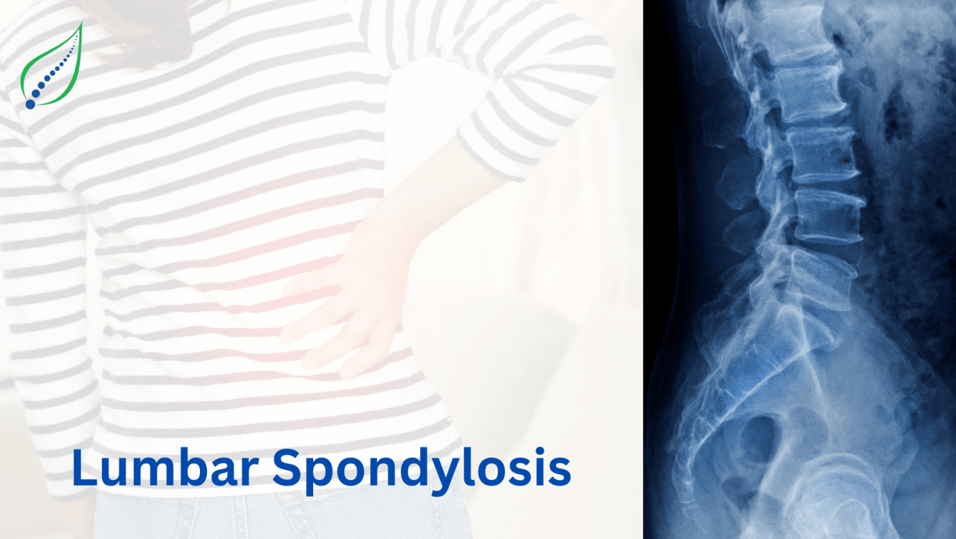 Lumbar Spondylosis