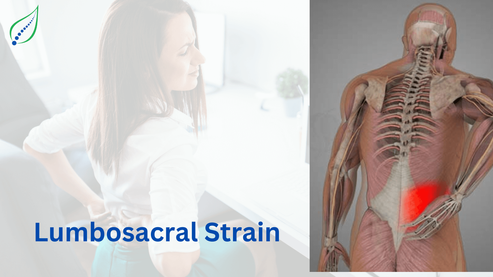 Lumbosacral Strain