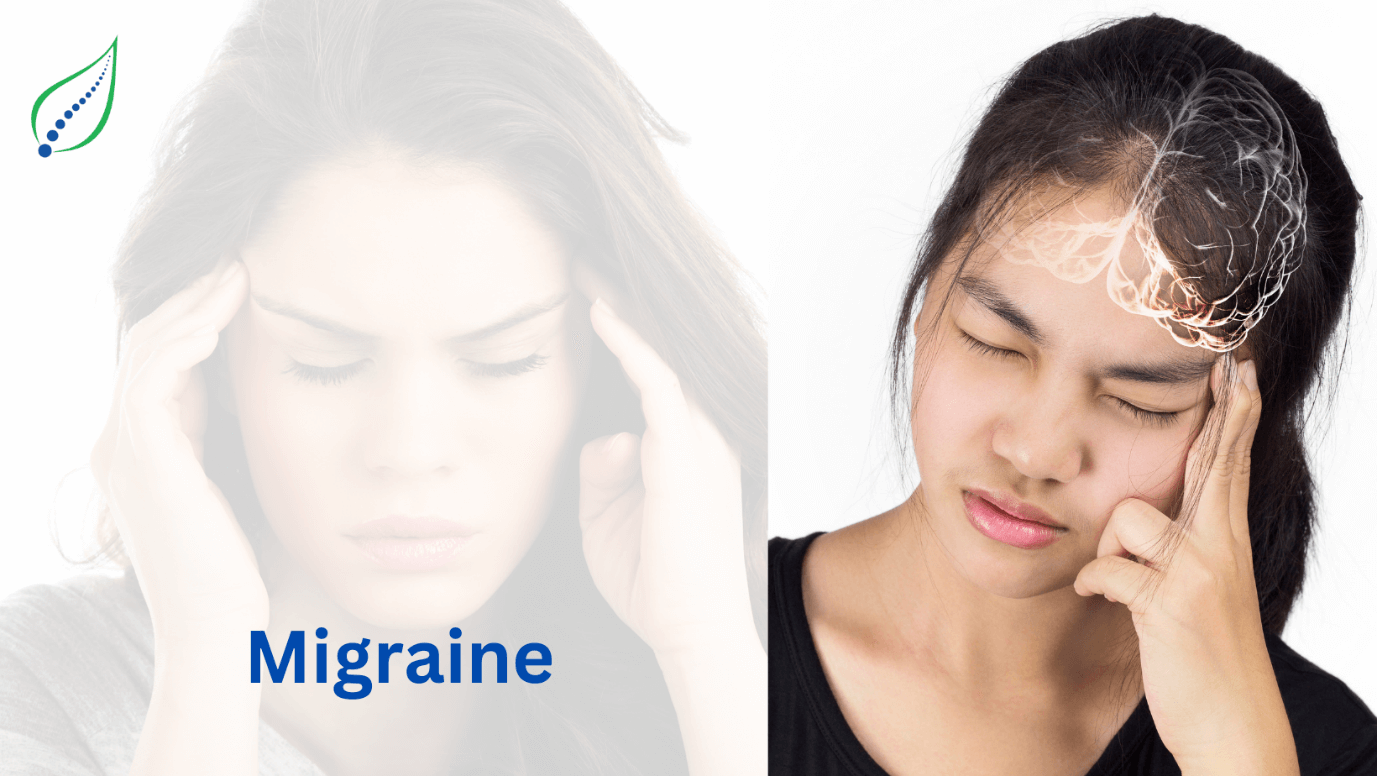 Migraine