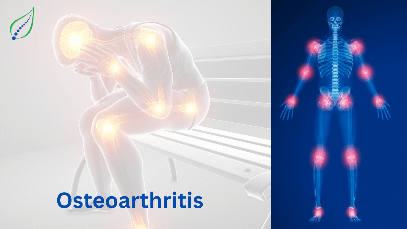 Osteoarthritis