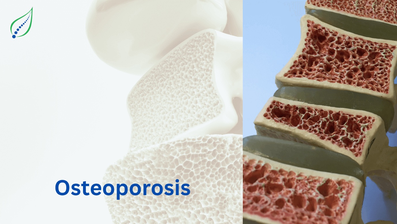 osteoporosis