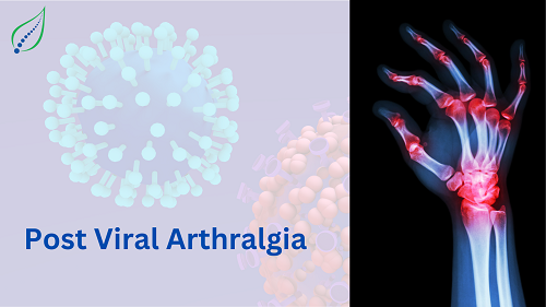 post-viral-arthralgia