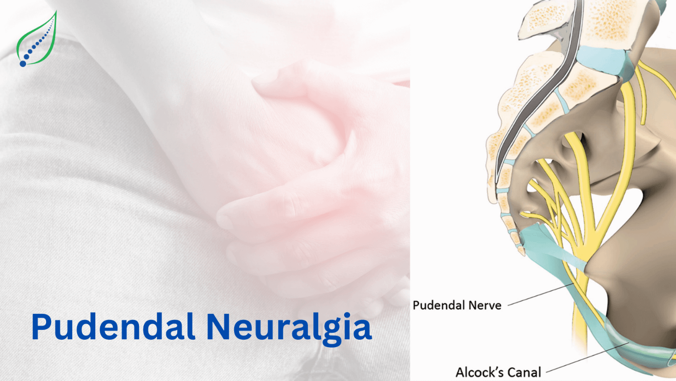 pudendal-neuralgia