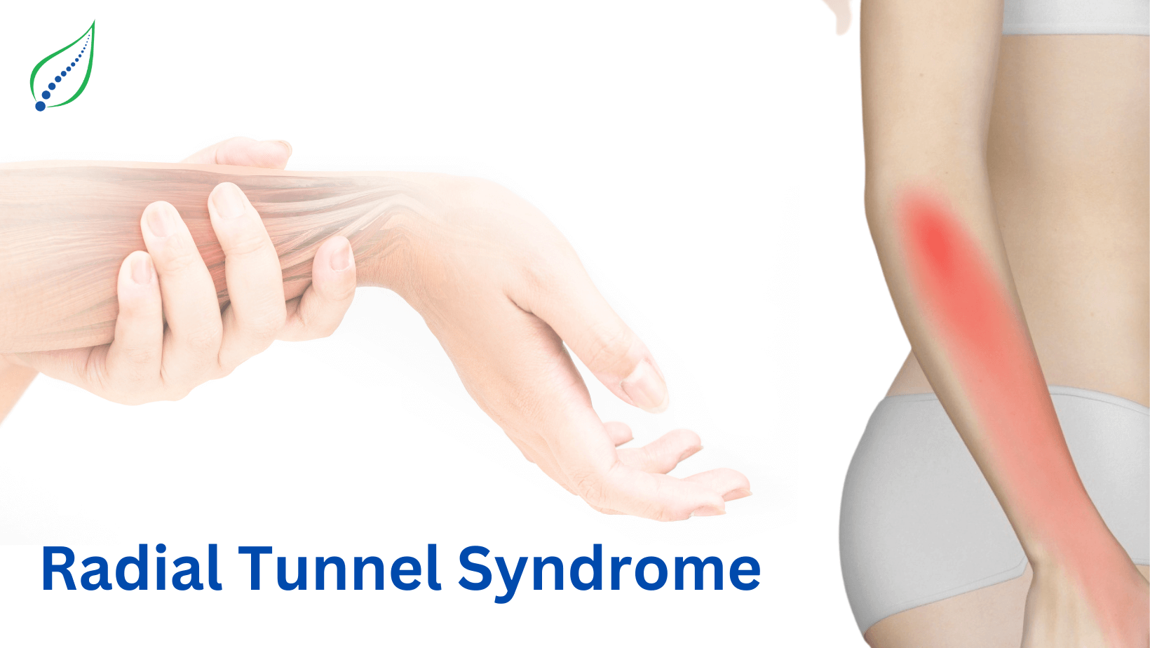 Radial Tunnel Syndrome