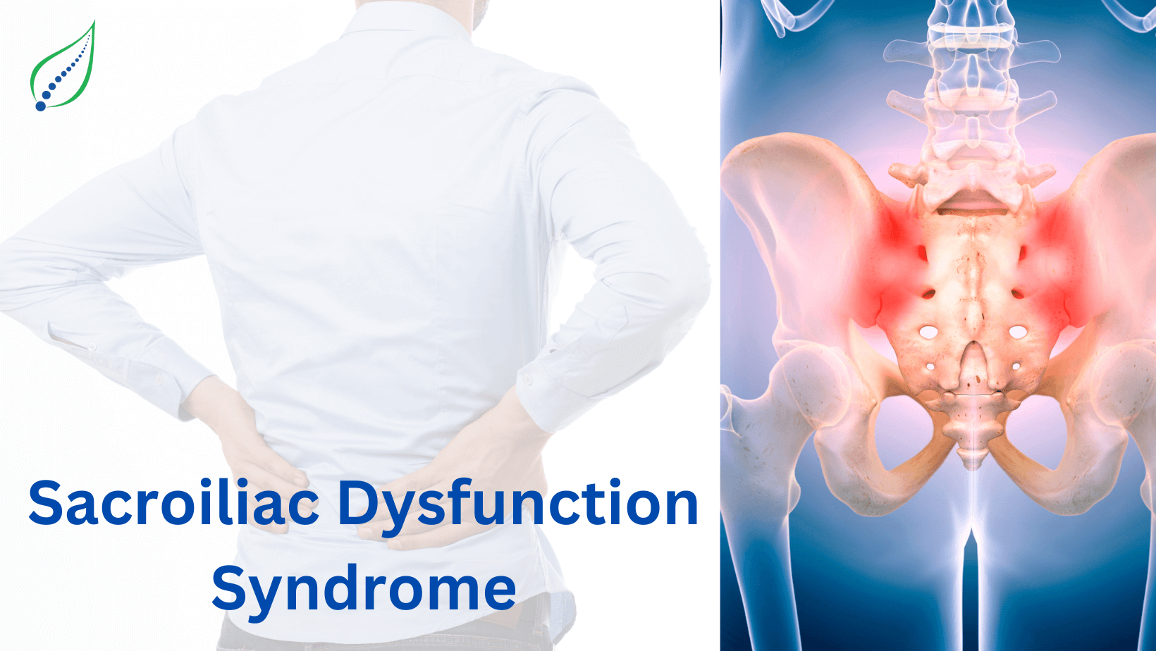Sacroiliac Dysfunction Syndrome