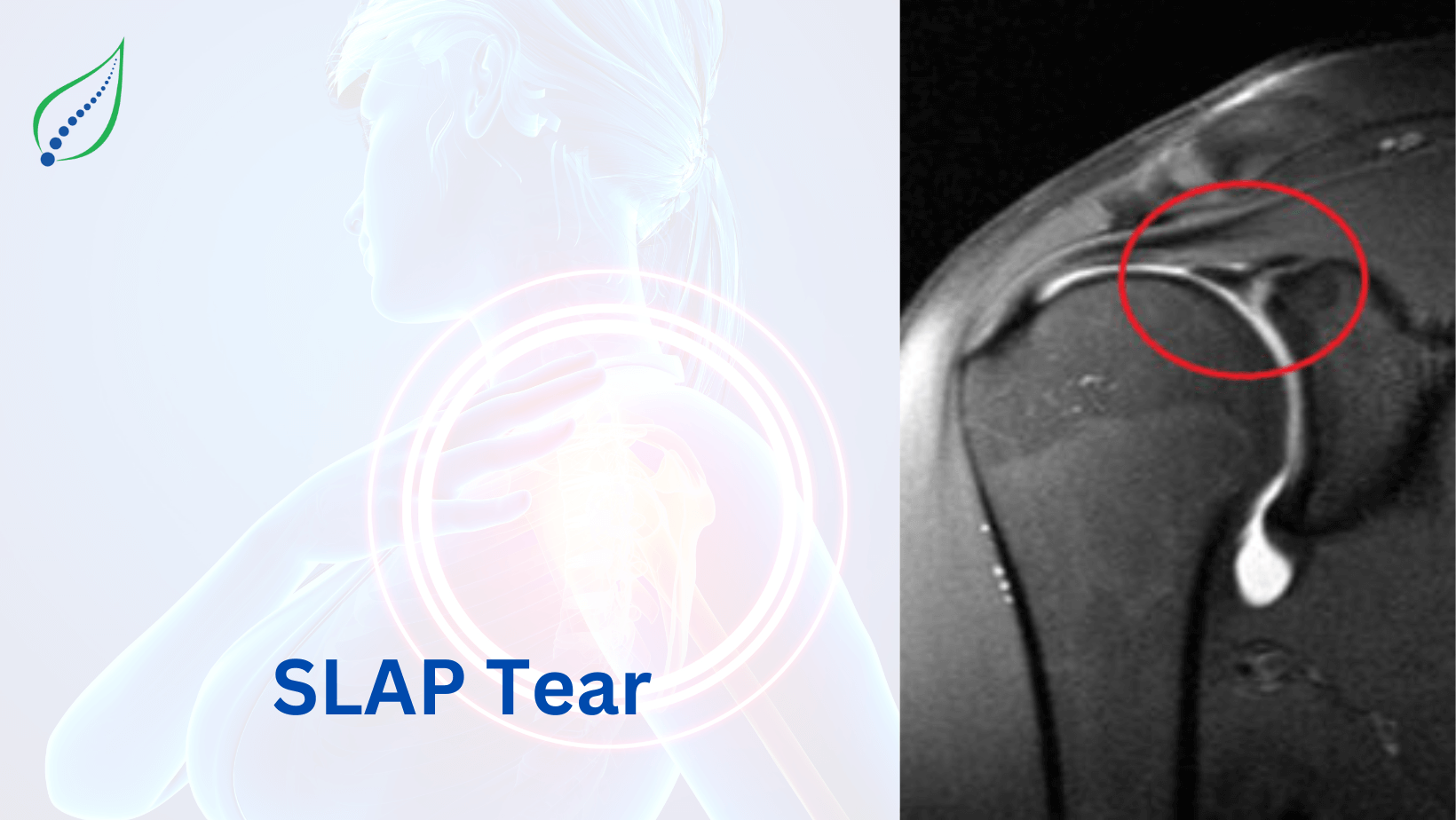 slap-tear