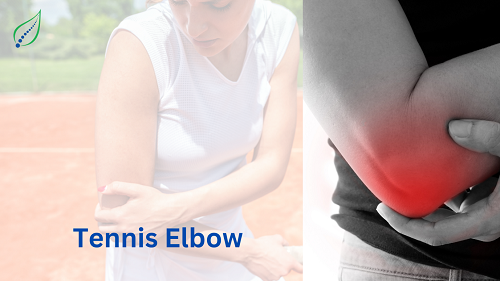 tennis-elbow