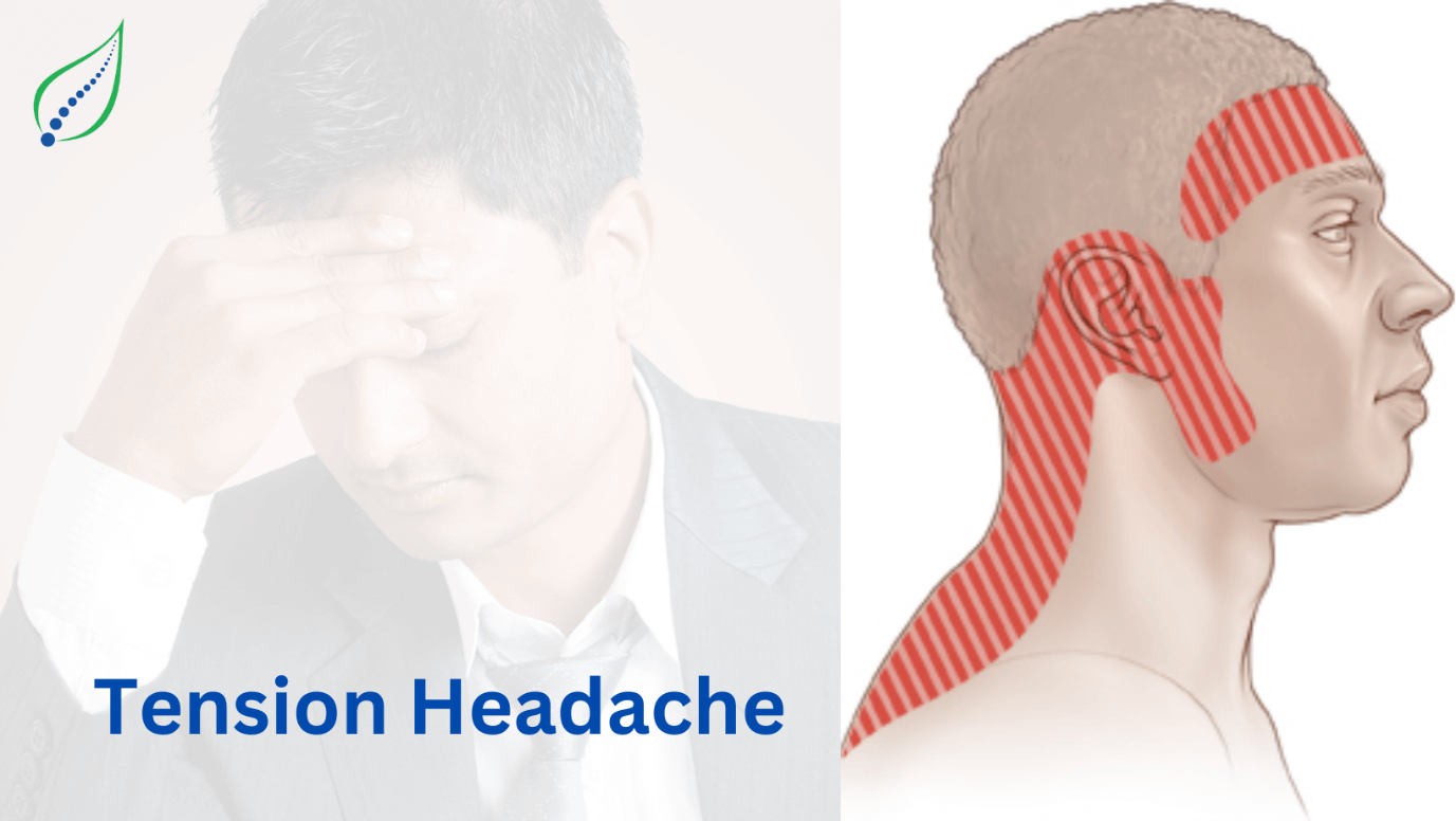 Tension Headache