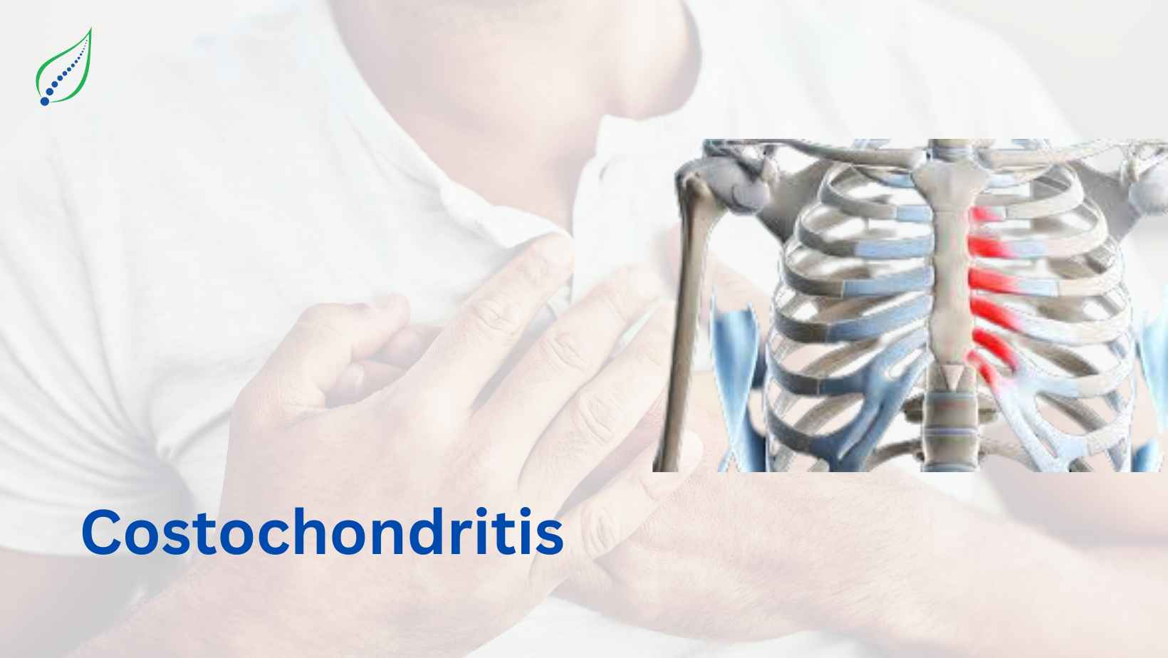 Costochondritis