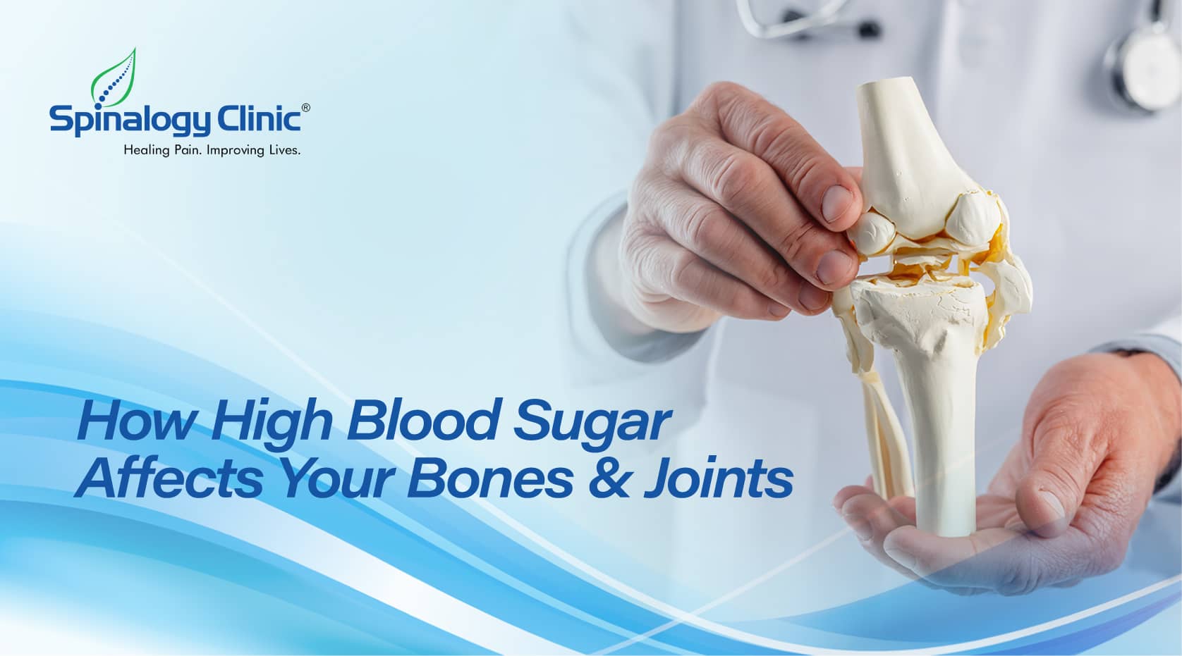 How High Blood Sugar Affects Your Bones and Joints