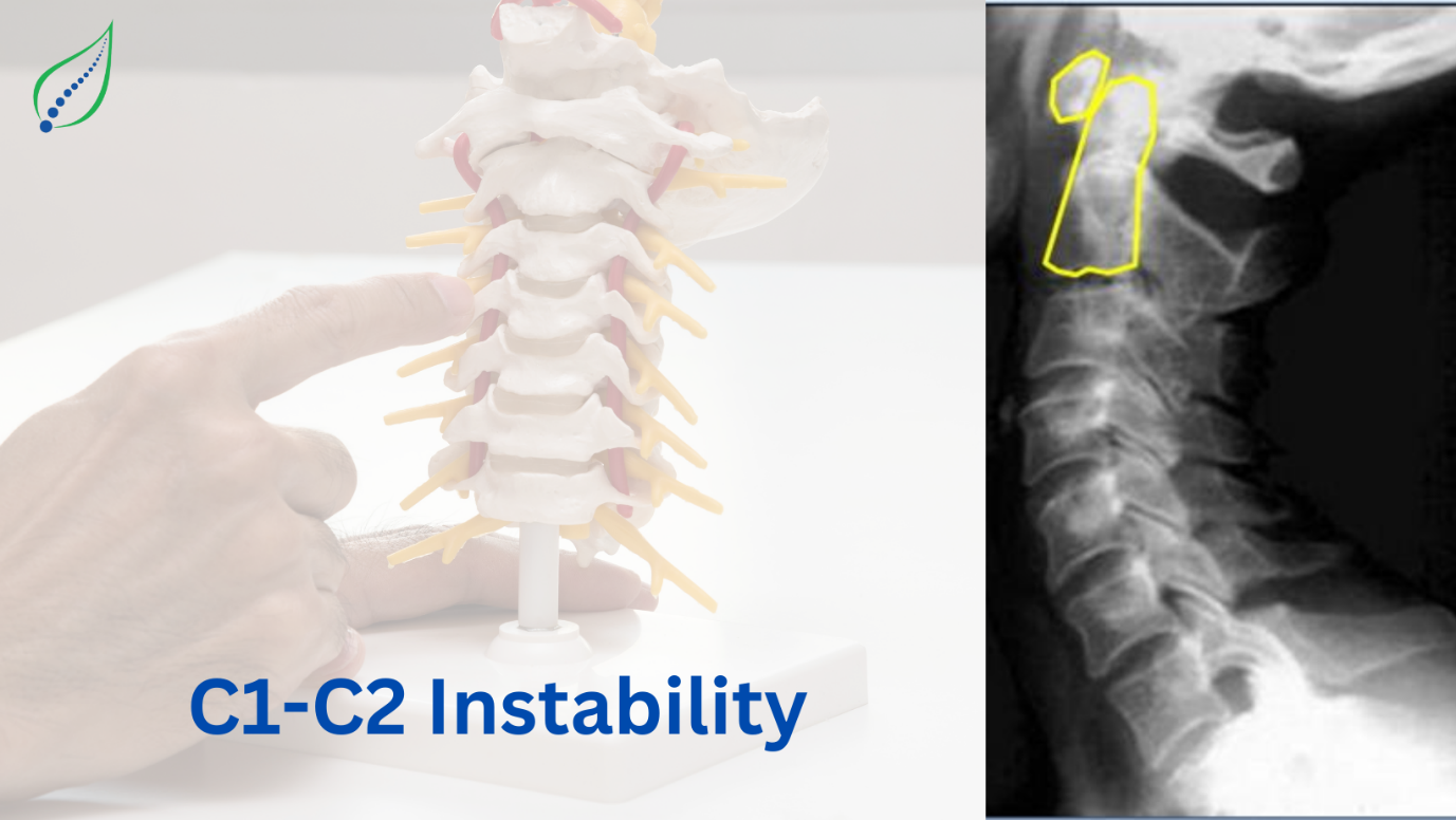 C1-C2 instability