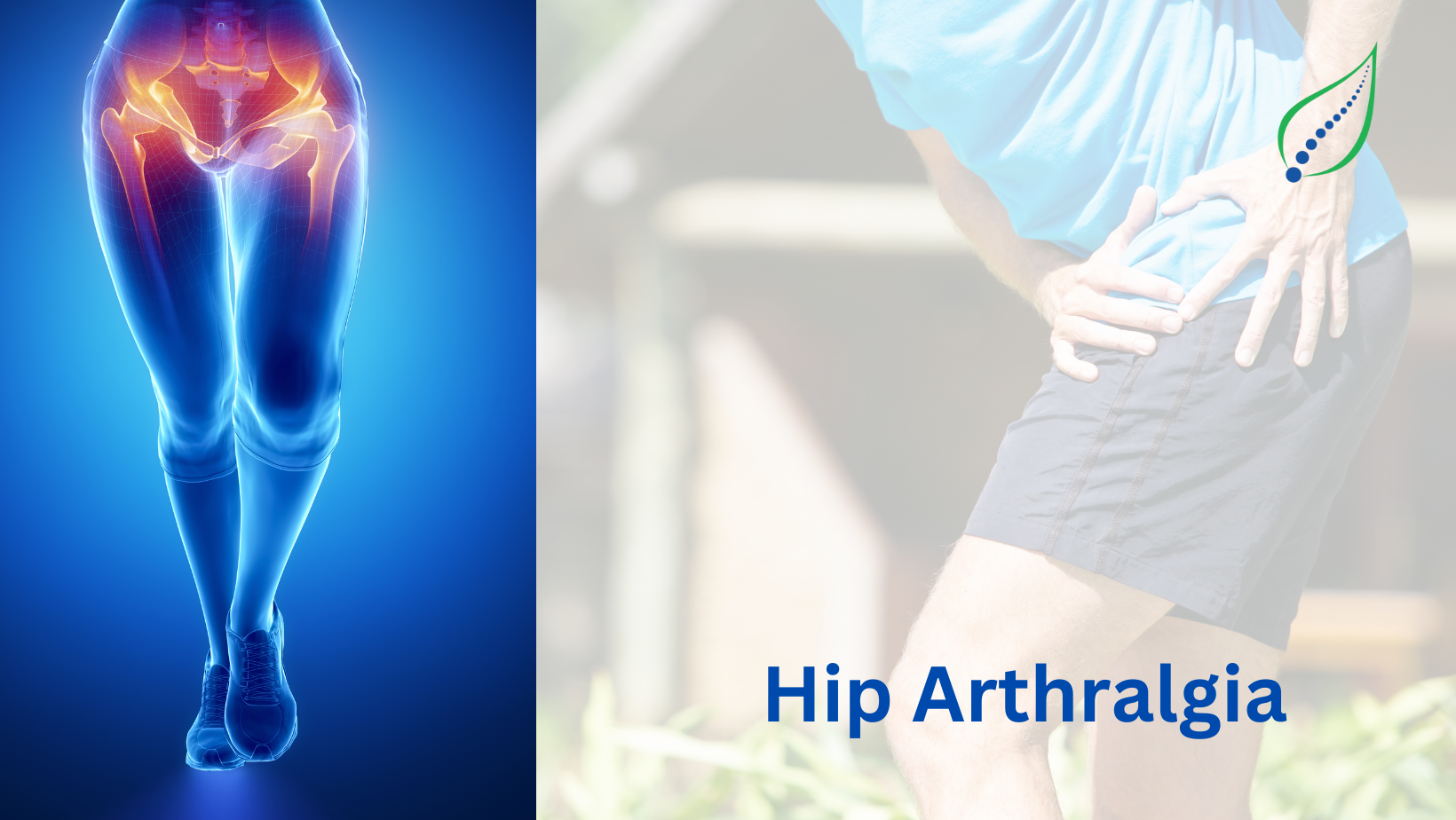 Hip Arthralgia