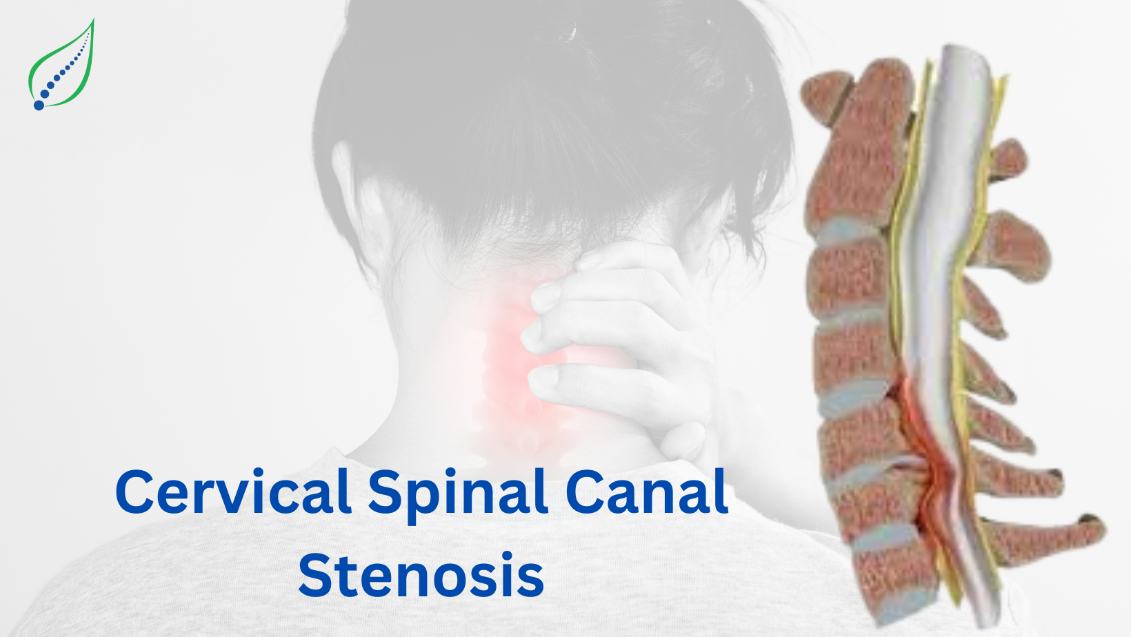 Cervical Spinal Canal Stenosis