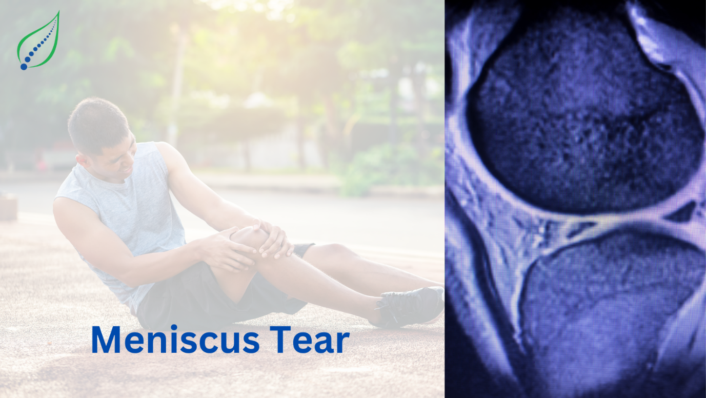 Meniscus Tear