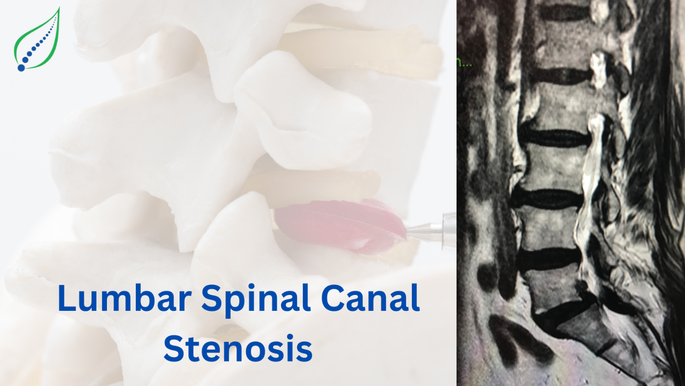 Lumbar Spinal Canal Stenosis