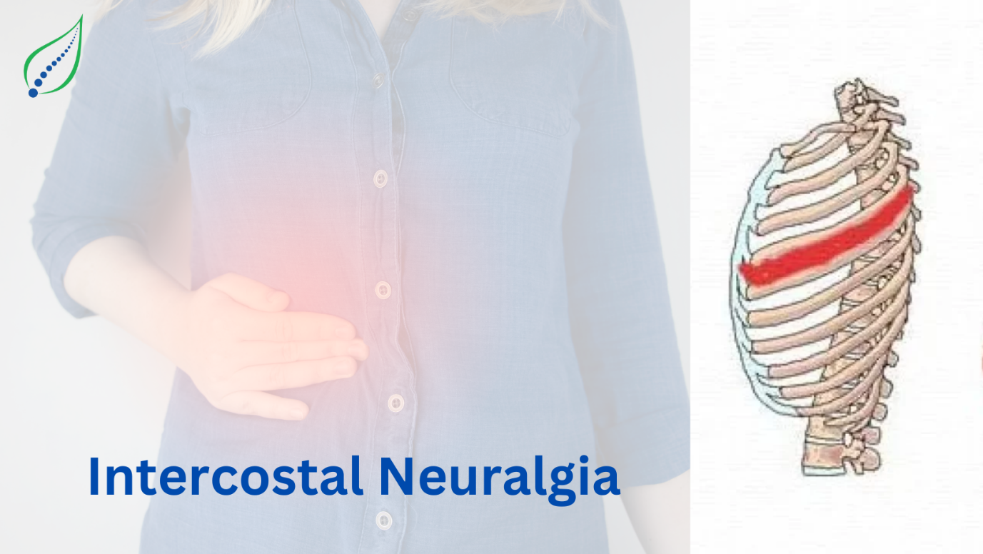 Intercostal Neuralgia