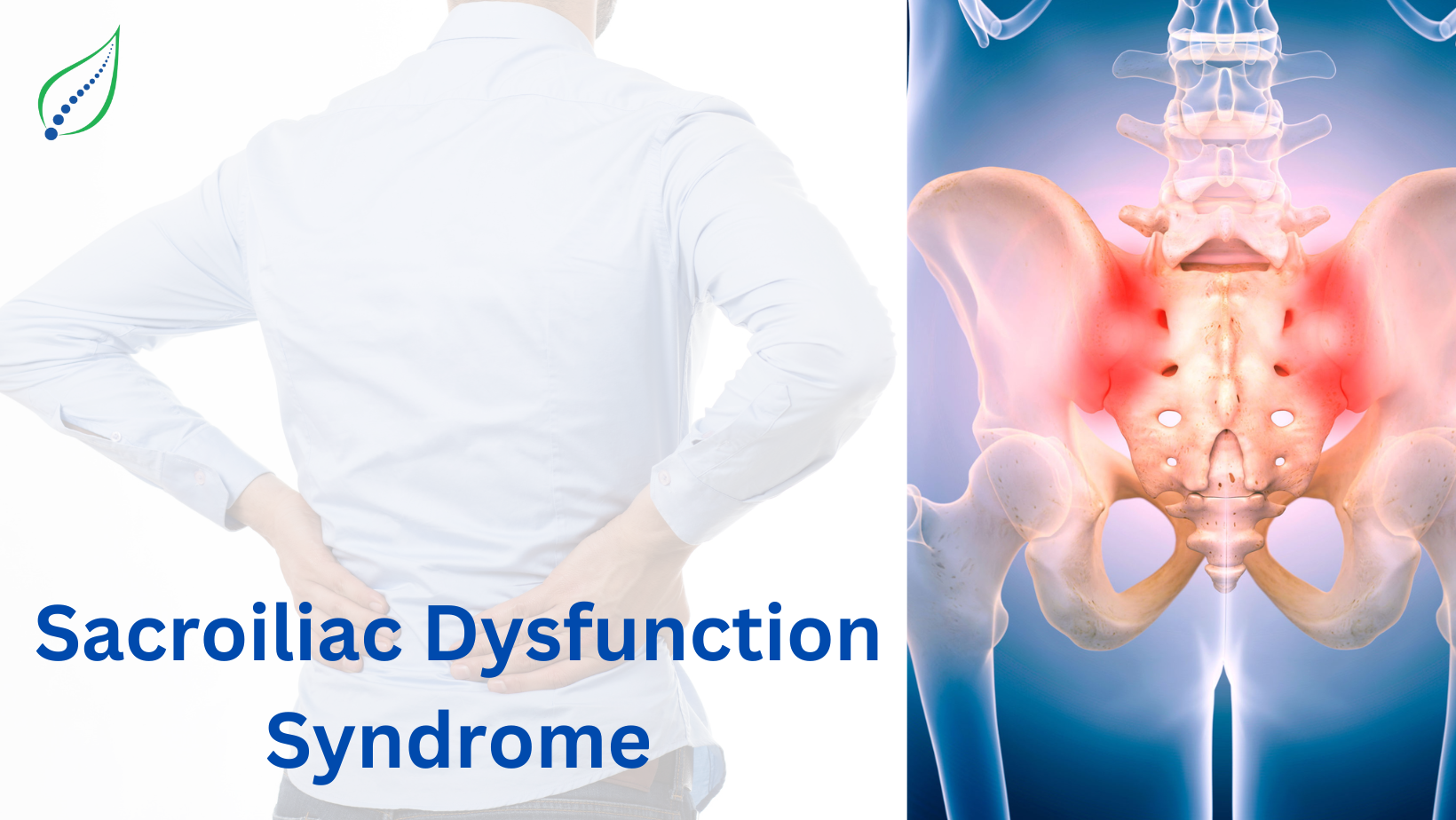 Sacroiliac Dysfunction Syndrome