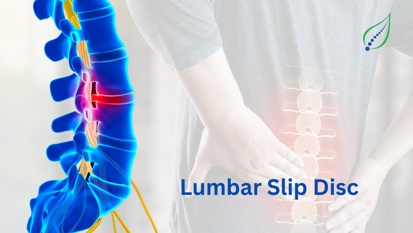 Lumbar Slip Disc