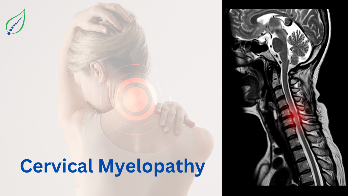 Cervical Myelopathy